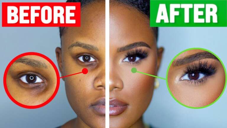 Natural Ways to Conceal Dark Under Eye Circles