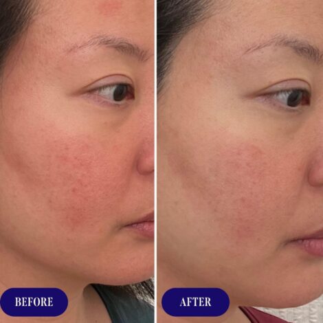 Three Ships Replenish Ceramides Blueberry Barrier Repair Serum, 30 ML - Image 7