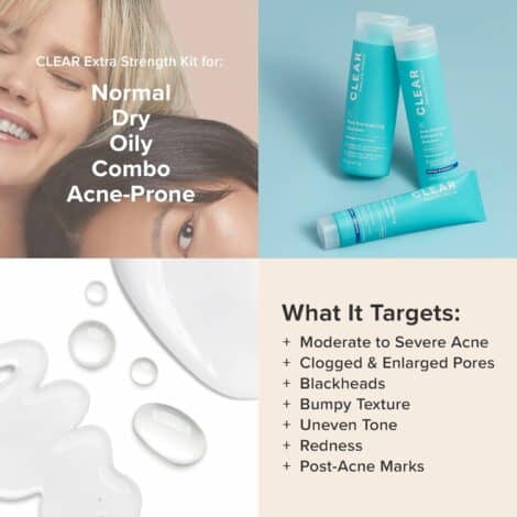 Paula's Choice CLEAR 3-Piece Acne Kit, Includes Daily Cleanser, 2% Salicylic Acid Exfoliant & Benzoyl Peroxide Treatment, Prevents & Treats Mild to Severe Acne & Breakouts, Fragrance-Free, Set of 3 - Image 5