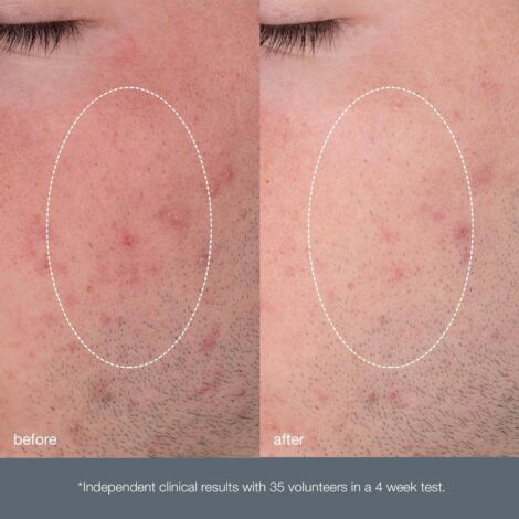 Dermalogica Daily Microfoliant, Face Exfoliator Scrub Powder with Salicylic Acid and Papaya Enzyme, Achieve Brighter, Smoother Skin Daily - Image 6