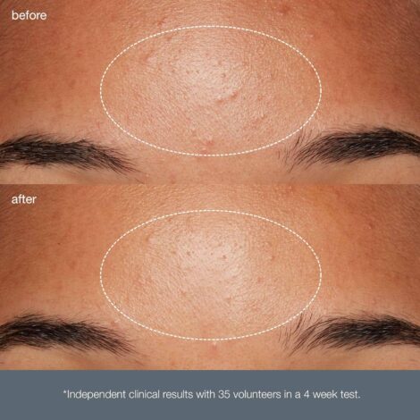 Dermalogica Daily Microfoliant, Face Exfoliator Scrub Powder with Salicylic Acid and Papaya Enzyme, Achieve Brighter, Smoother Skin Daily - Image 7